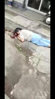 爆料者受伤视频  第2张